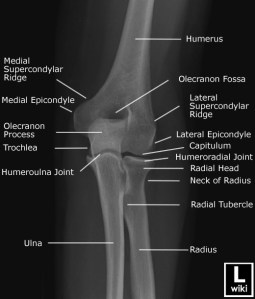 Oblique radiograph of the elbow with labels.