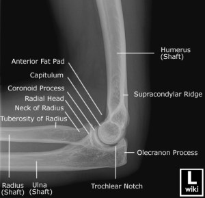 Lateral radiograph of the elbow with labels.