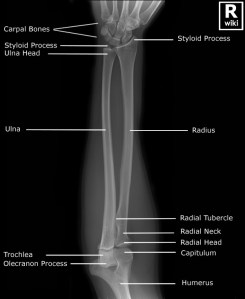 Frontal radiograph of the forearm with labels.