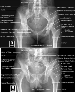 Labeled radiographic anatomy of the male (bottom image) and female (top image) pelvis.