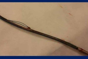 Photograph of the Riata wire with insulation failure. 