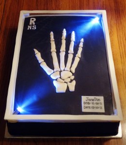 Hand x-ray birthday cake. Do you know what bones are missing?